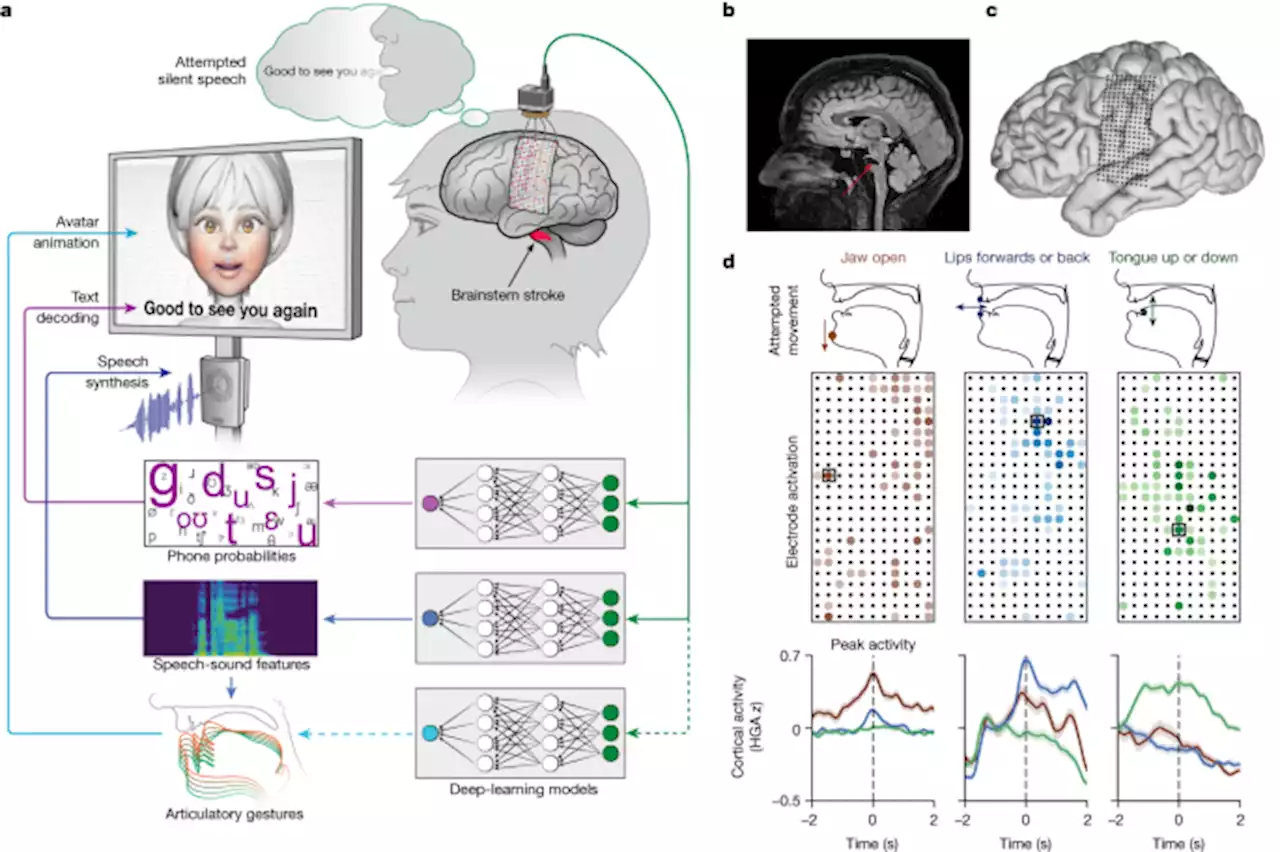 A high-performance neuroprosthesis for speech decoding and avatar control
