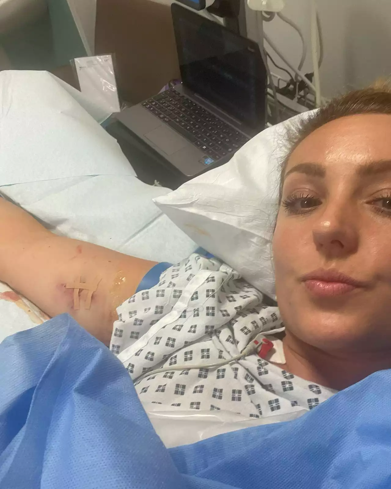 Strictly's Amy Dowden in terrifying sepsis battle as doctors rushed to save her