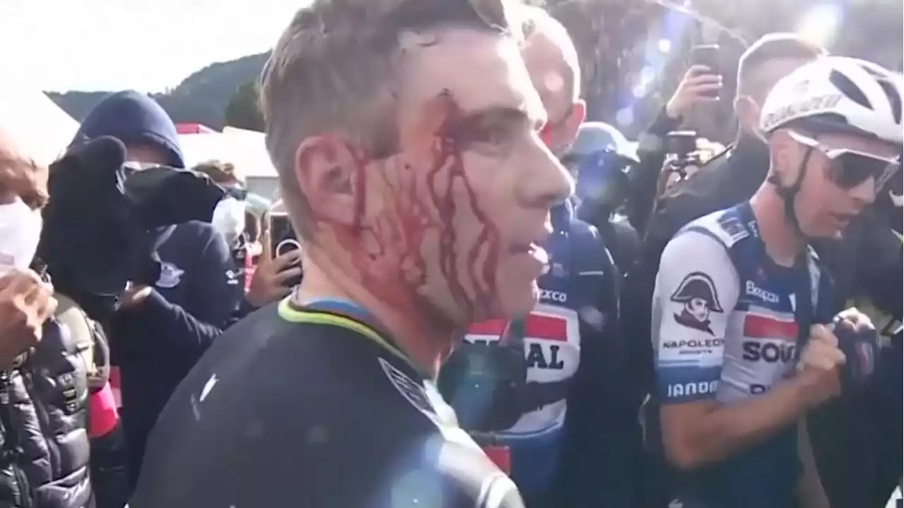 Vuelta: Etappensieger Evenepoel blutet stark im Gesicht!