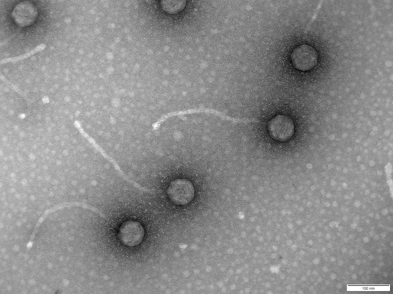 Fagos, un virus ‘come’ bacterias que combate resistencia a los antibióticos