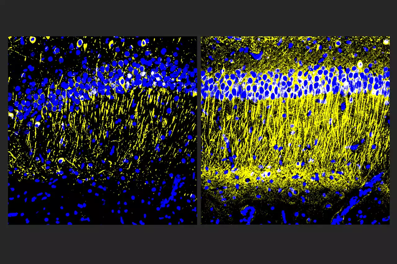 Molecule reduces inflammation in Alzheimer's models