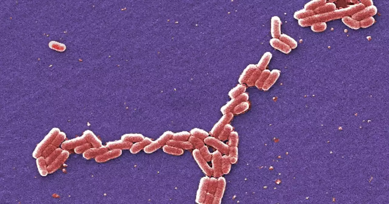 Four students hospitalized in E. coli outbreak at the University of Arkansas