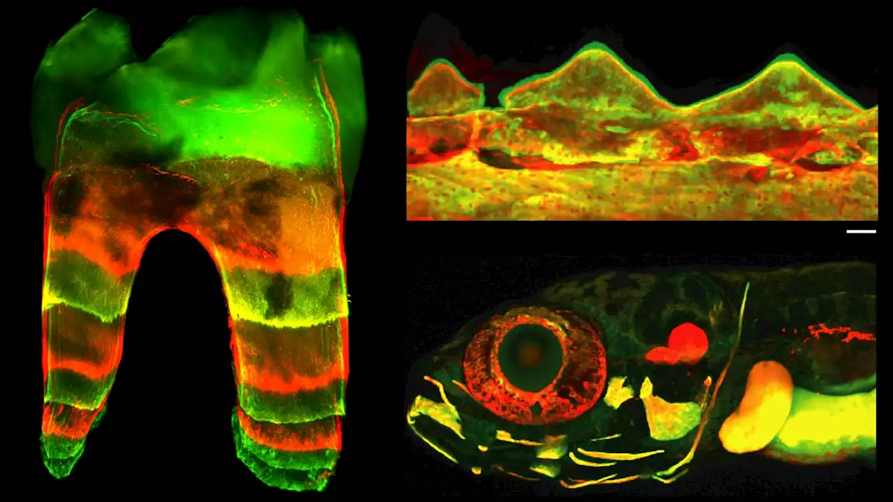 Glowing dye lets us peek inside growing bones and teeth