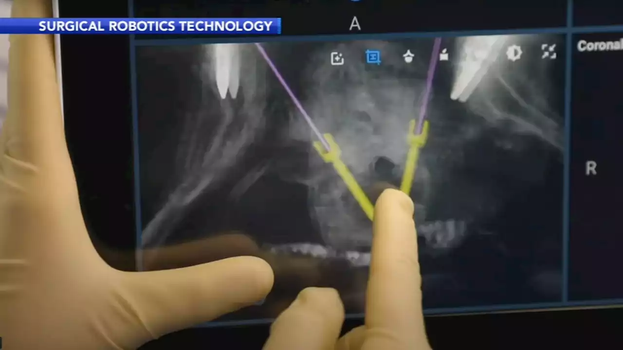 Technology aids spine surgeon for better outcomes in relieving chronic back pain