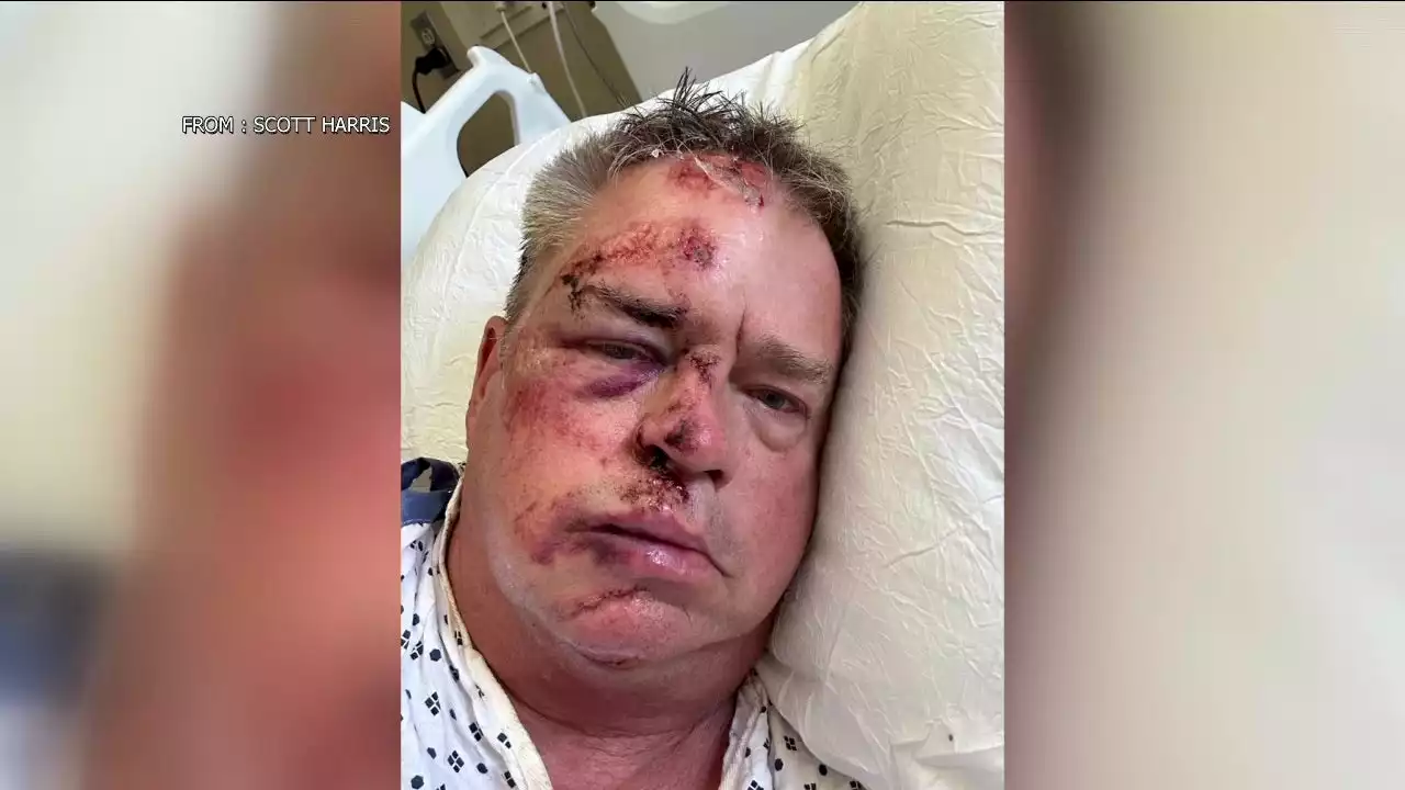 Retired Naval officer gets over 100 stitches after being mugged while walking dog in Philadelphia