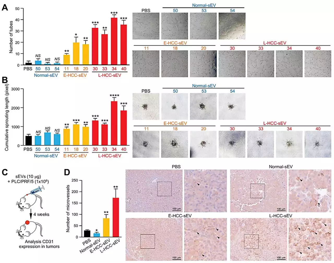 Potential strategy for treating liver cancer: Study discovers signaling pathway mediated by extracellular vesicles