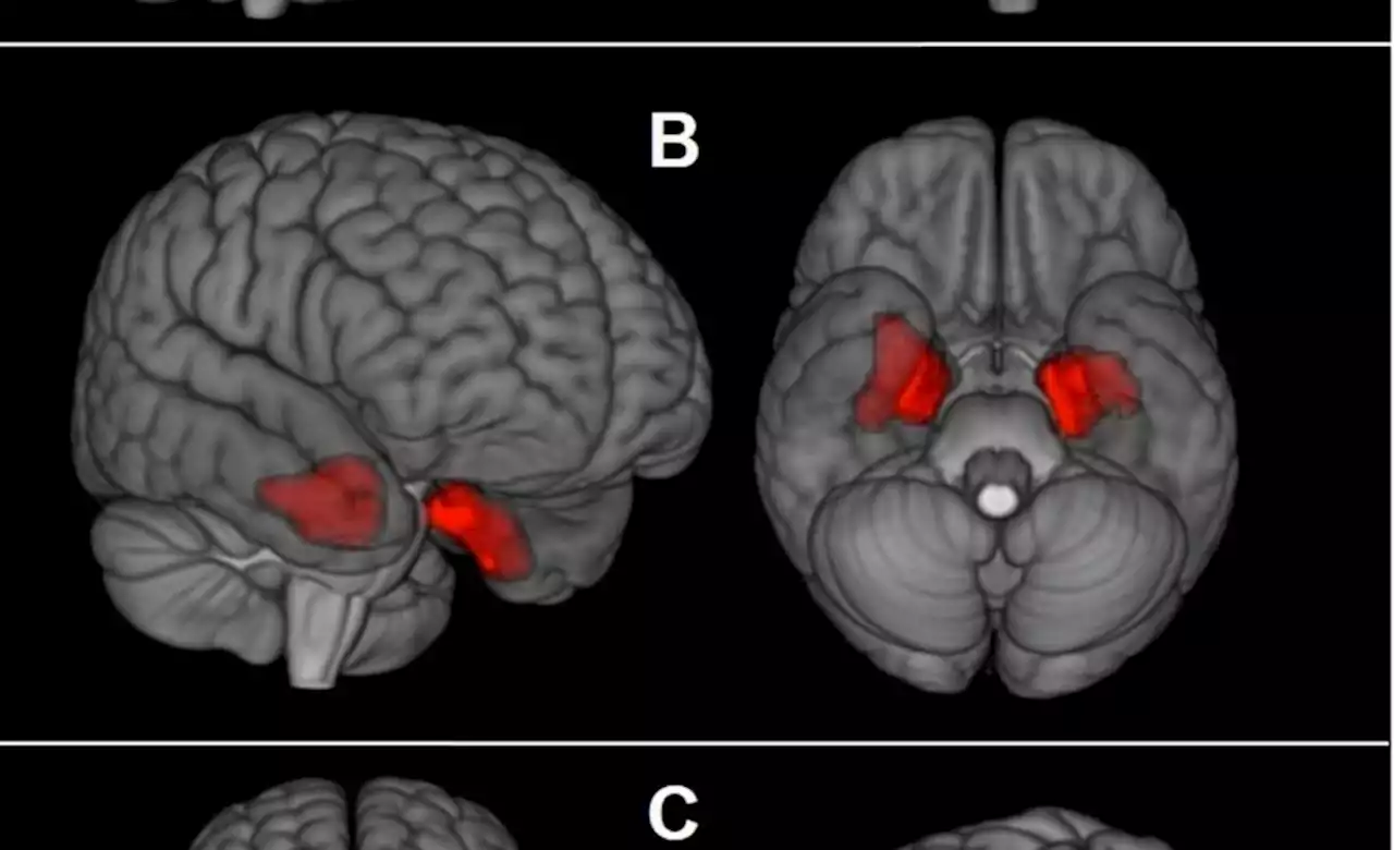 41% of contact sport athletes who died young had CTE, Boston University study finds