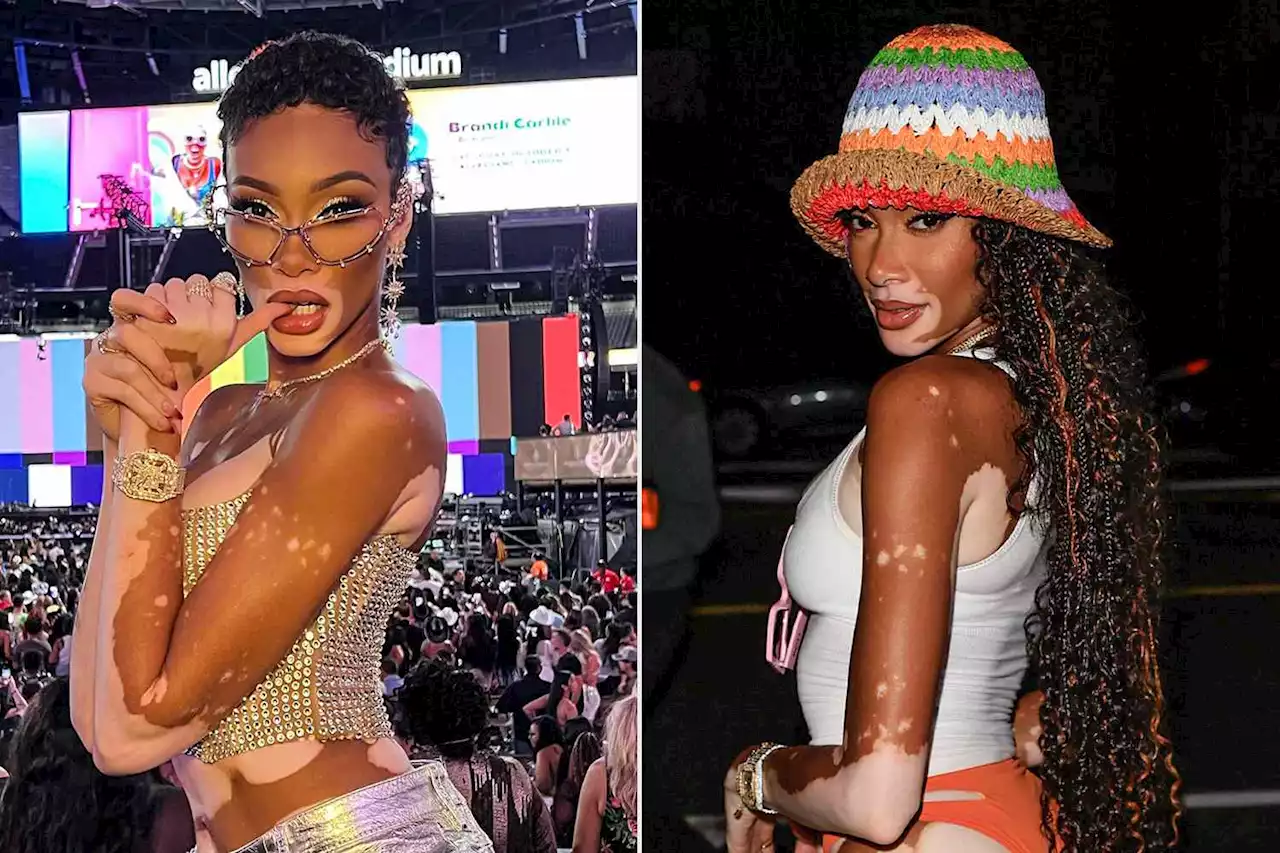 Model Winnie Harlow Debuts New Cropped Haircut at Beyoncé Concert: It's a 'Hair Renaissance'