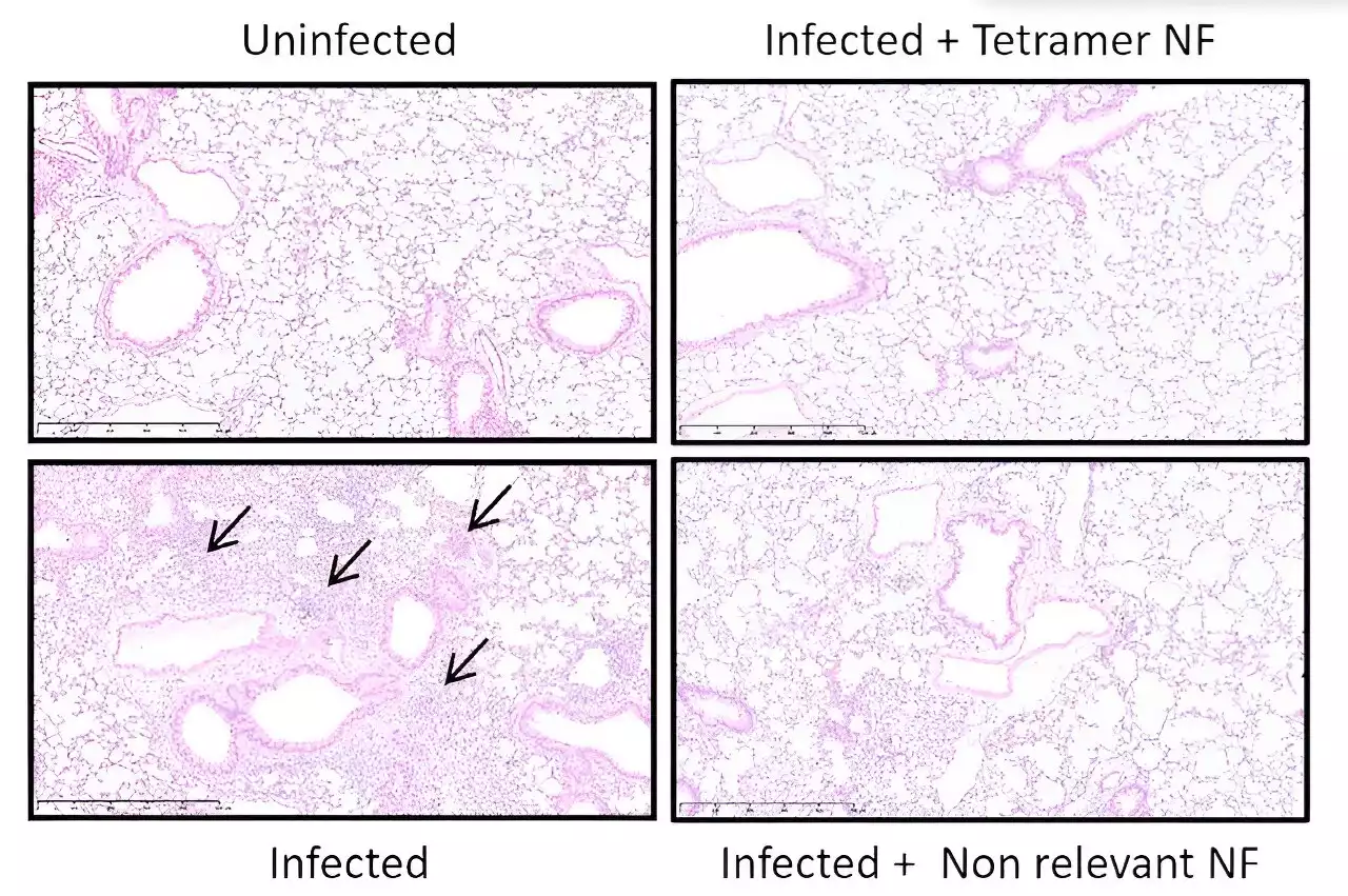 Inhalable molecules neutralize SARS-CoV-2 in mice