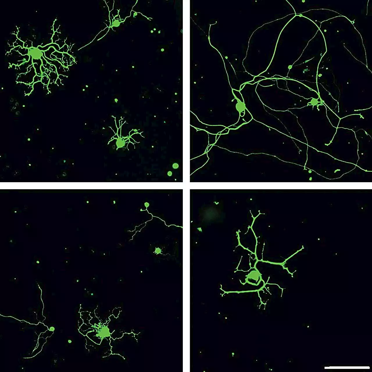 Unlocking a secret nerve cell regenerator