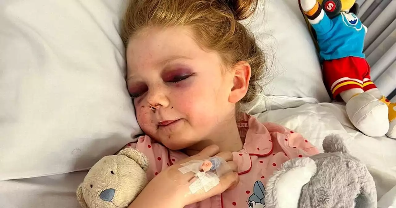 Girl, eight, broke 15 skull bones after being knocked over by Zorb