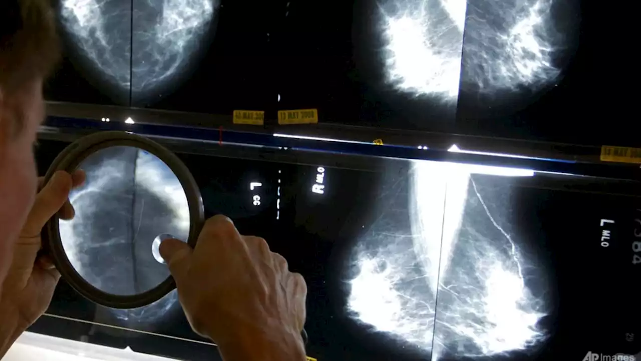 Commentary: AI improves breast cancer detection, but will that save lives?