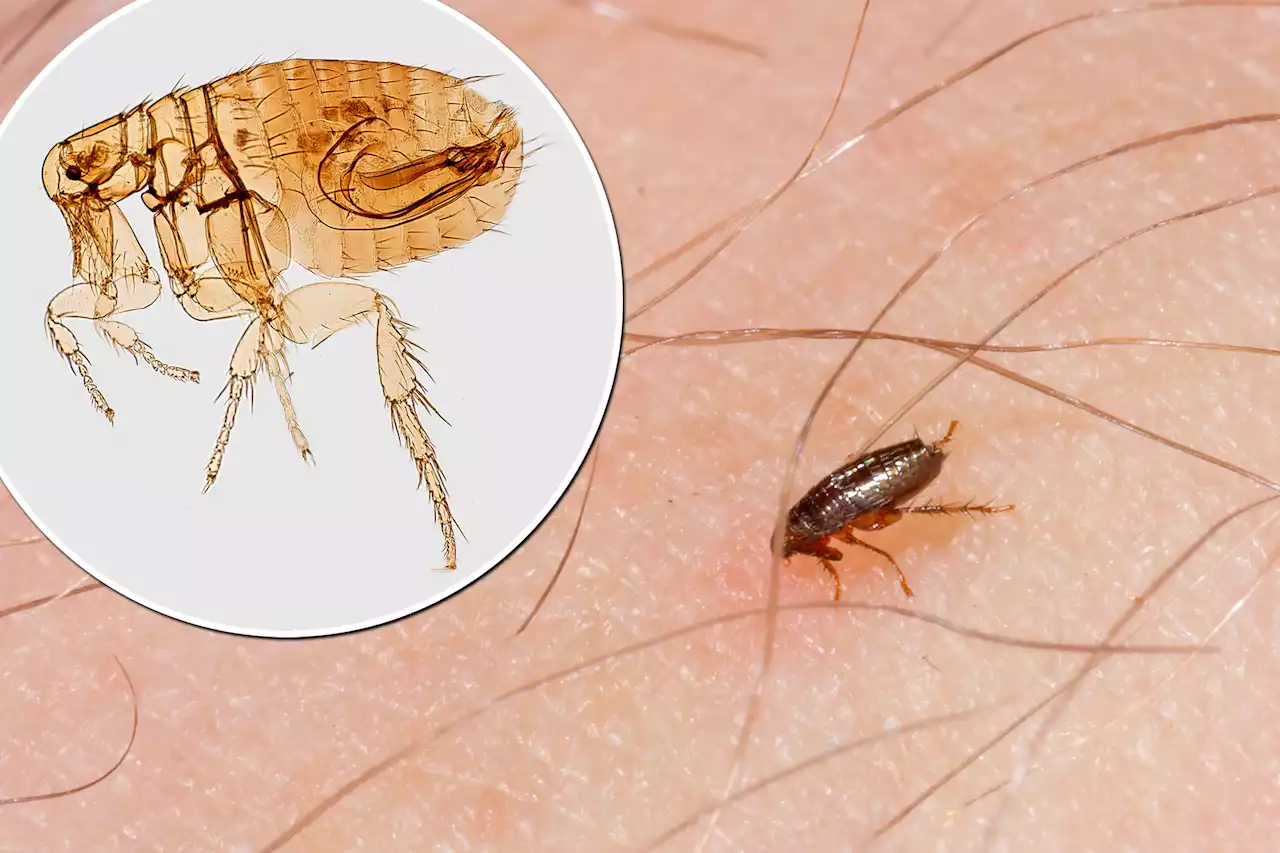 Flea-borne typhus deaths are rising in LA: new CDC report