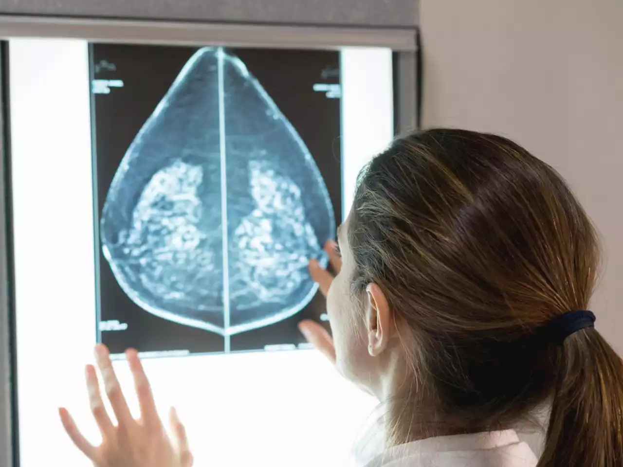 Doctors are better at detecting breast cancer when they get help from AI, large study finds