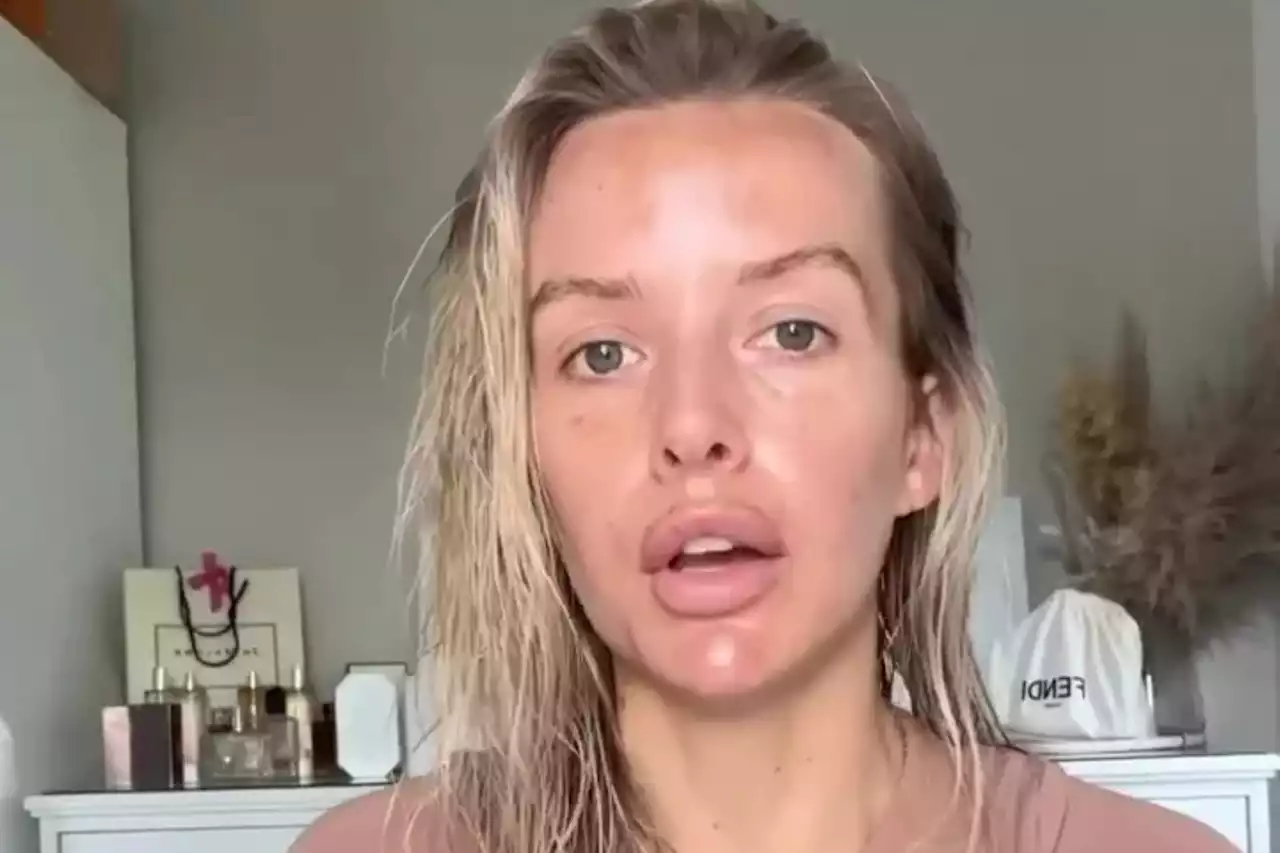 Faye Winter shows off her ‘real skin’ as she reveals sun damage