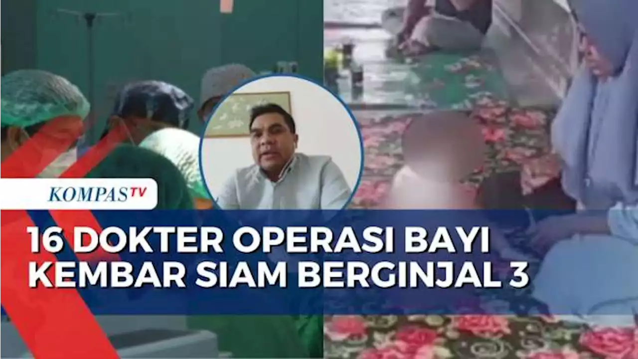 Begini Kondisi Bayi Kembar Siam Berginjal 3 Pasca Operasi Pemisahan