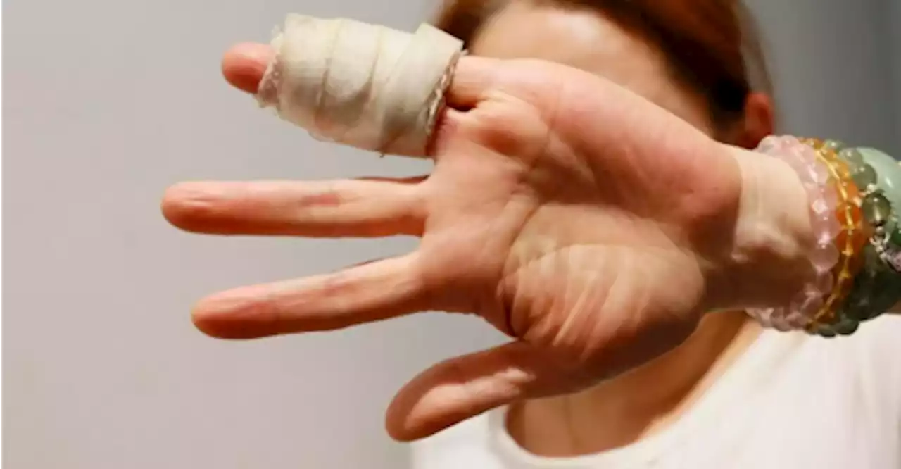 S’porean almost loses fingers getting caught between MRT door