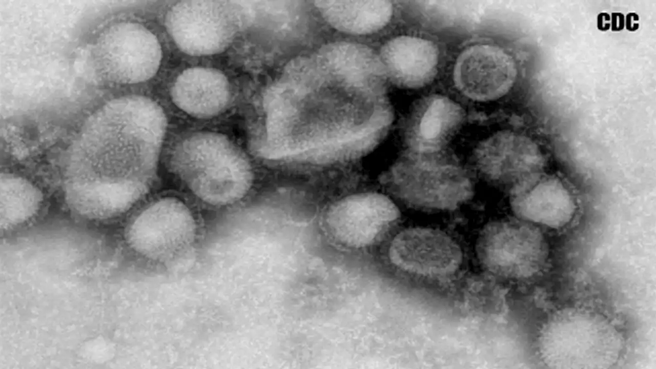 Swine flu outbreak in Michigan: 2 people infected at pig exhibits, CDC reports