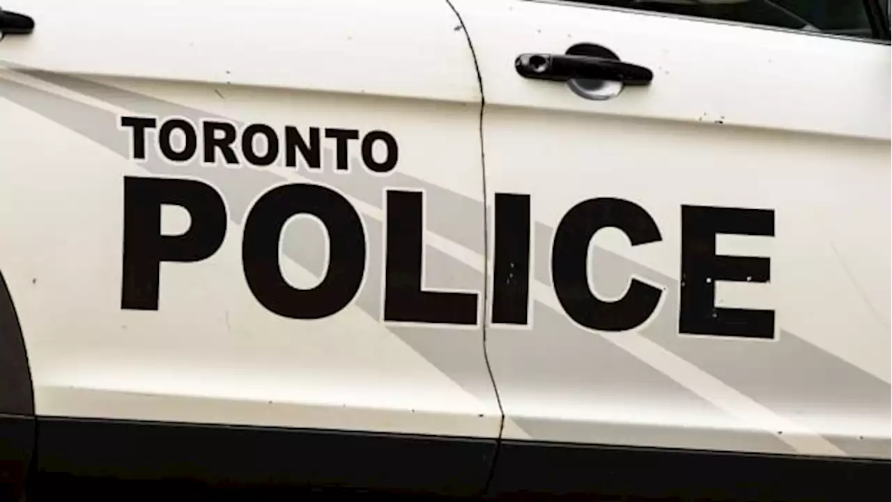 Pedestrian in serious condition after being struck by Toronto police vehicle | CBC News