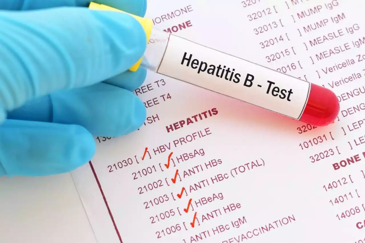 ‘Hepatitis B prevalence quadruples HIV in Taraba’ | The Guardian Nigeria News - Nigeria and World News