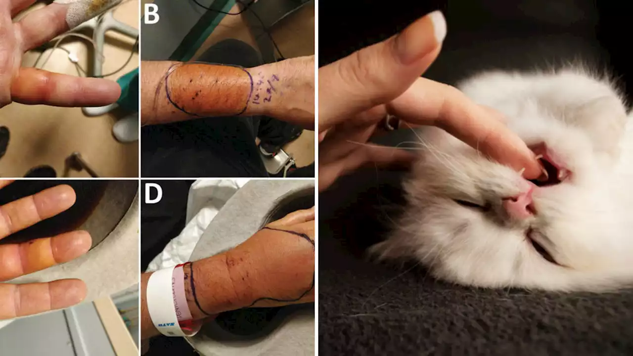 Brit rushed for emergency surgery as arm swells up in mysterious new bacterial infection after feral cat bite