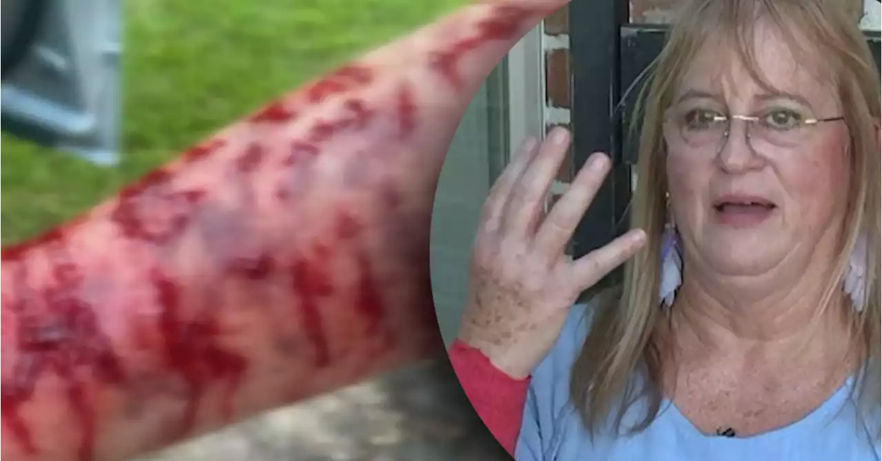 US woman attacked by snake and hawk - at same time