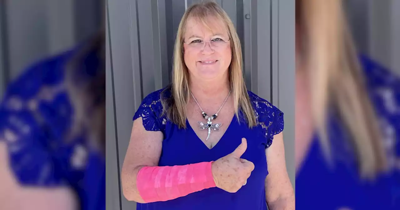 Texas Woman Attacked by Snake and Hawk in Bizarre Encounter