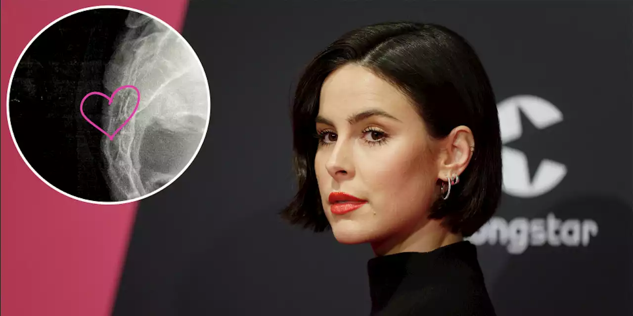 Unfall in Kitzbühel – Lena Meyer-Landrut schwer verletzt