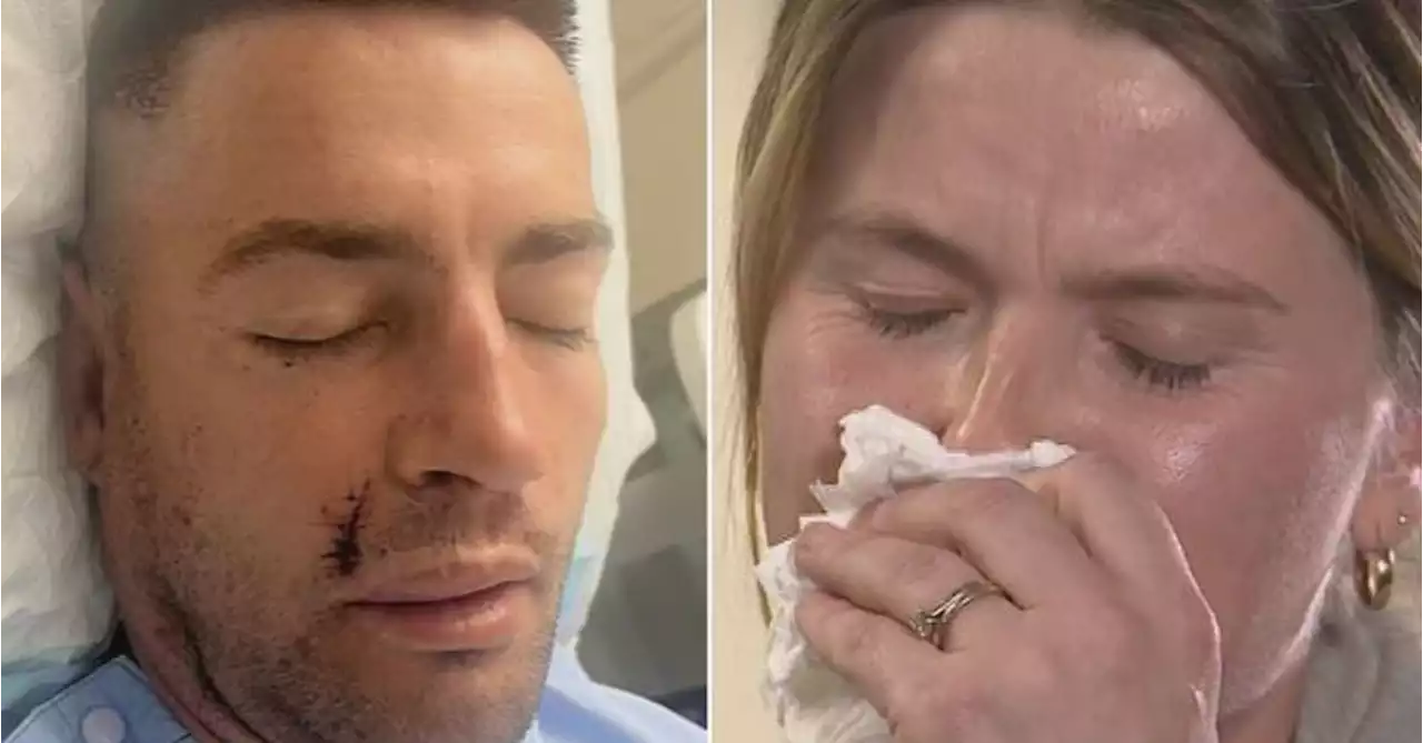 Wife opens up after alleged coward punch lands husband in hospital