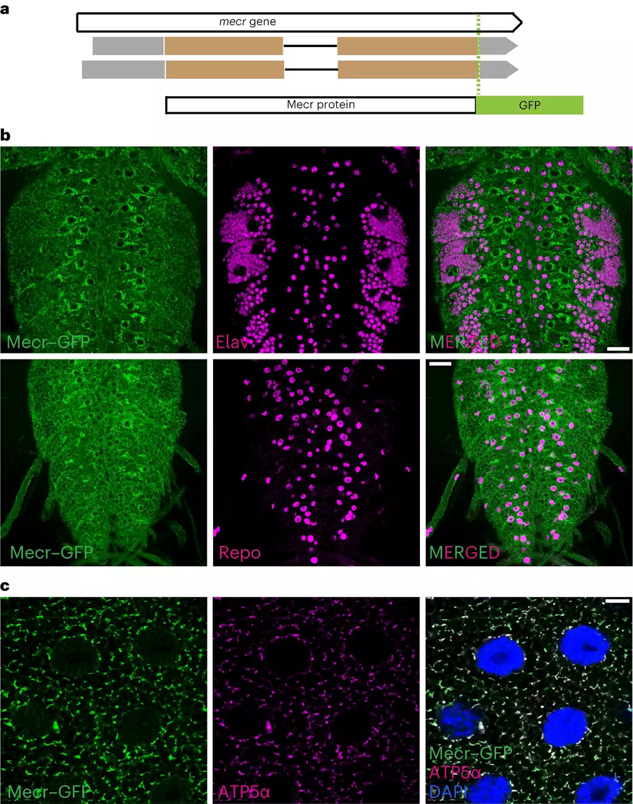 Excess ceramide and disrupted iron metabolism in neuronal mitochondria found to be the cause for MEPAN syndrome