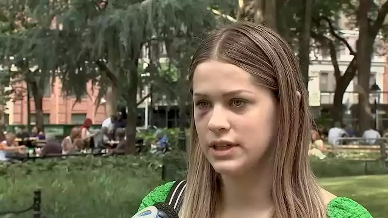 College student speaks out about after being randomly attacked on way to work