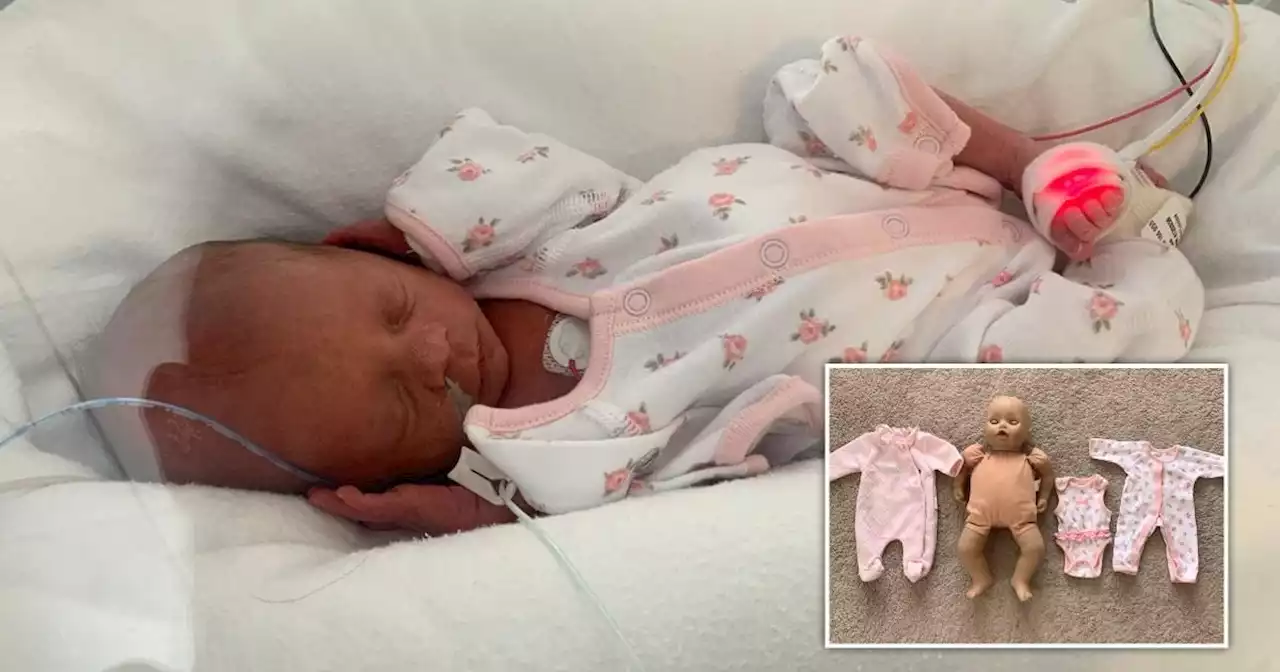 Premature baby so small she had to wear doll's clothes defies the odds