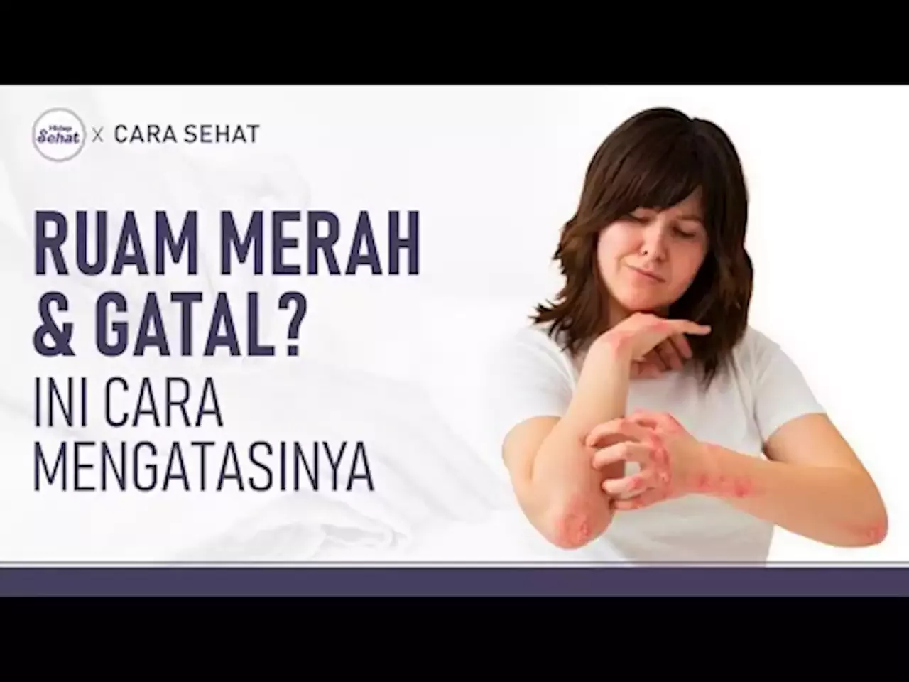 Ruam Dan Gatal Karena Dermatitis? Ini Cara Mengatasinya