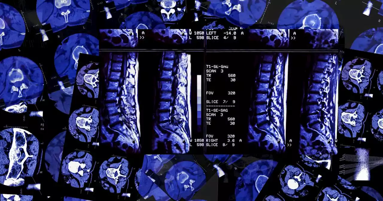 Silicon Valley’s quest to live forever now includes $2,500 full-body MRIs