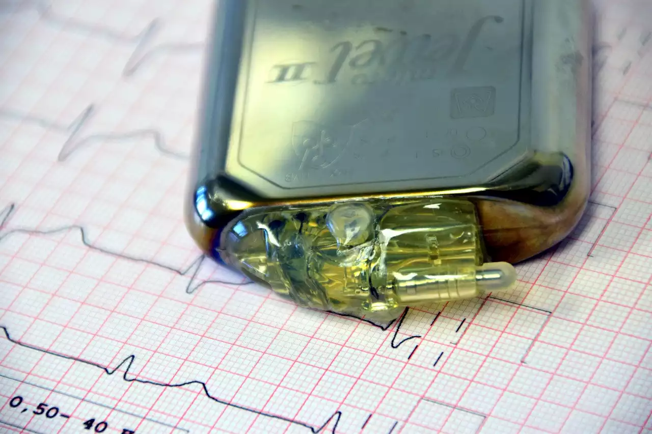 High-risk heart failure patients should receive implantable defibrillators sooner, says study