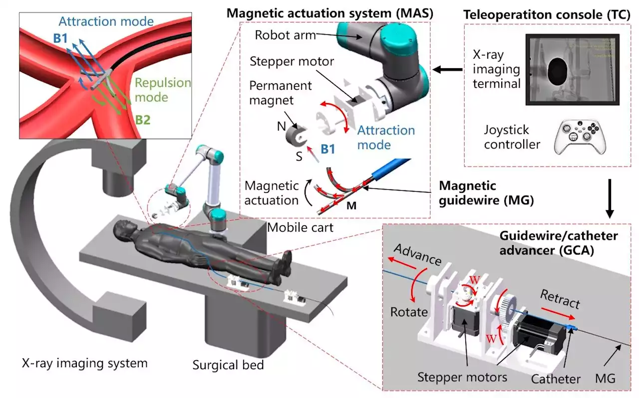 Researchers develop magnetically controlled guidewire robot system for vascular interventional surgery