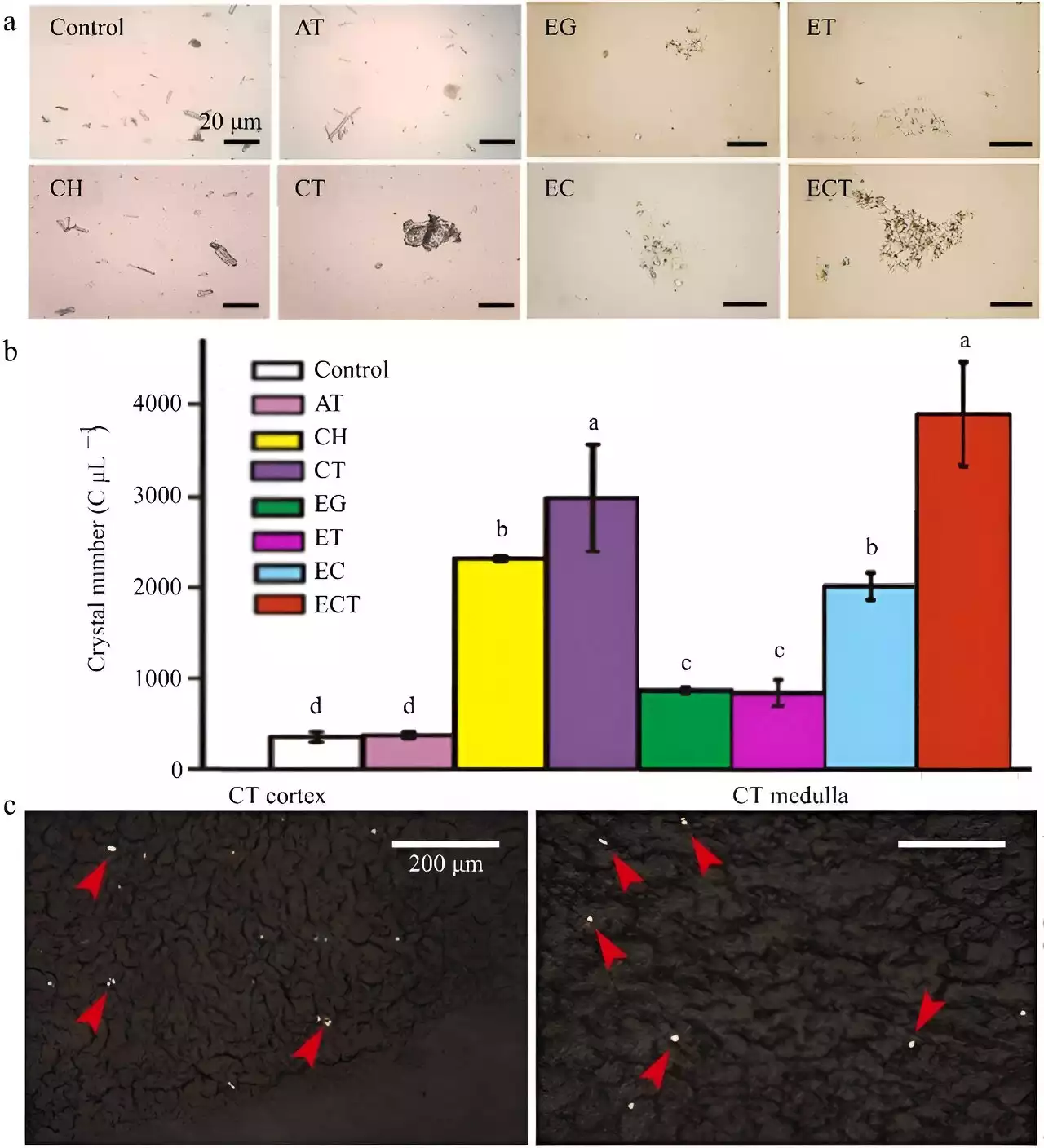 Study illuminates synergistic effects of dietary cholesterol and fruit tannins in kidney stone formation