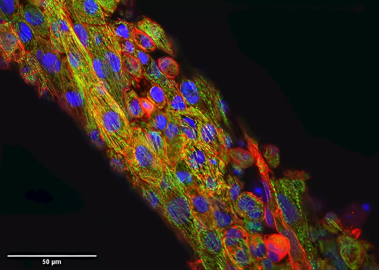 Virtual drug quiets noise in heart tissue images