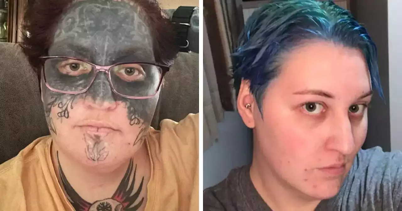 “Keep Tearing Me Apart” Woman Whose Face Was Tattooed Against Her Will