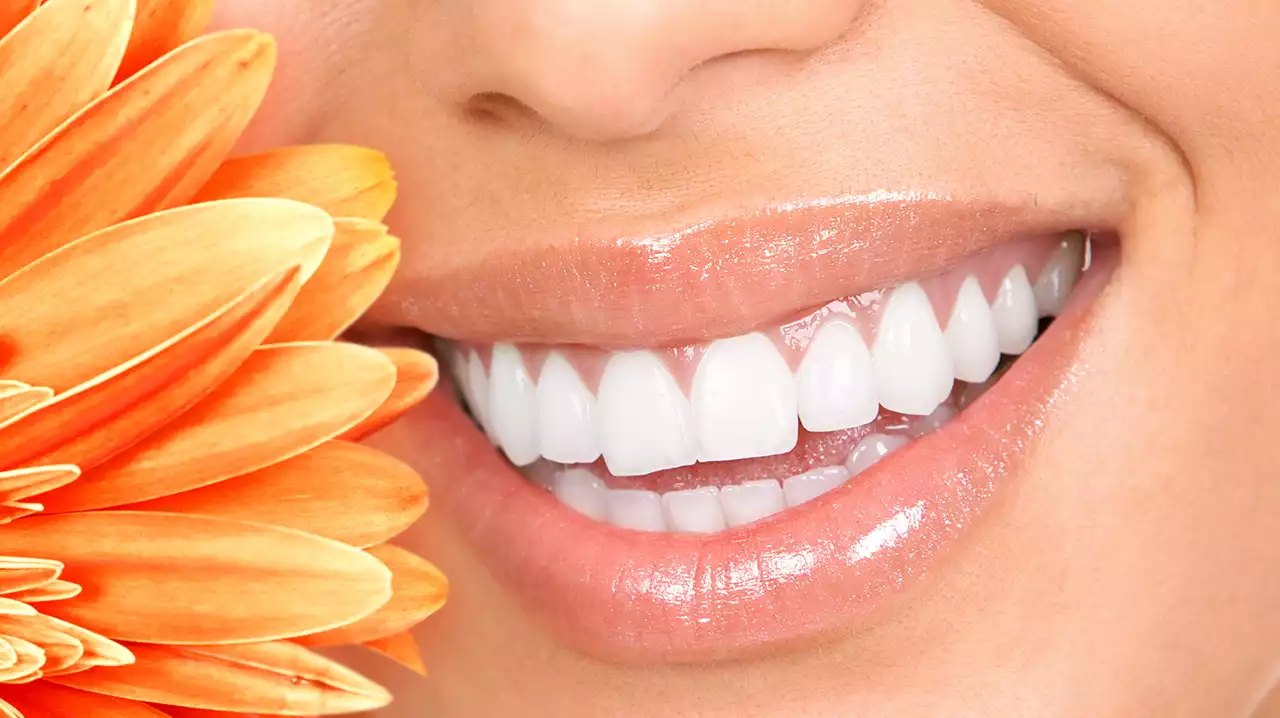 With Medica Smile, experience the Magic of Porcelain Veneers in Turkey