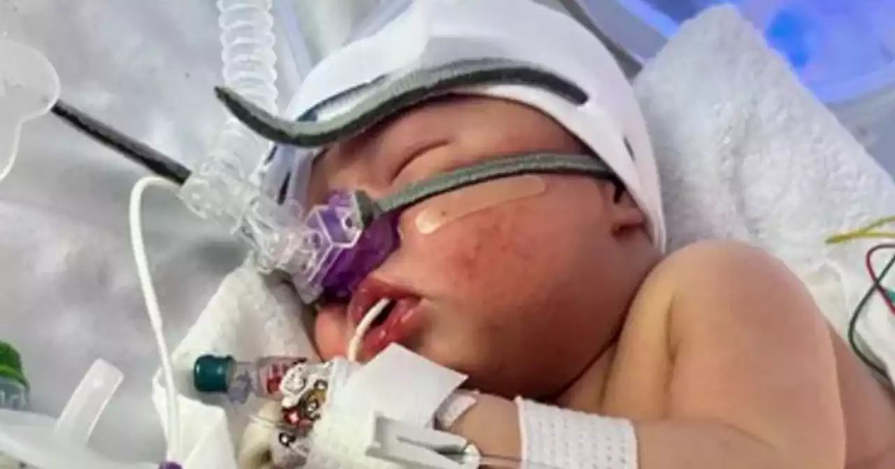 Newborn baby boy born with sepsis rushed to intensive care in Glasgow hospital