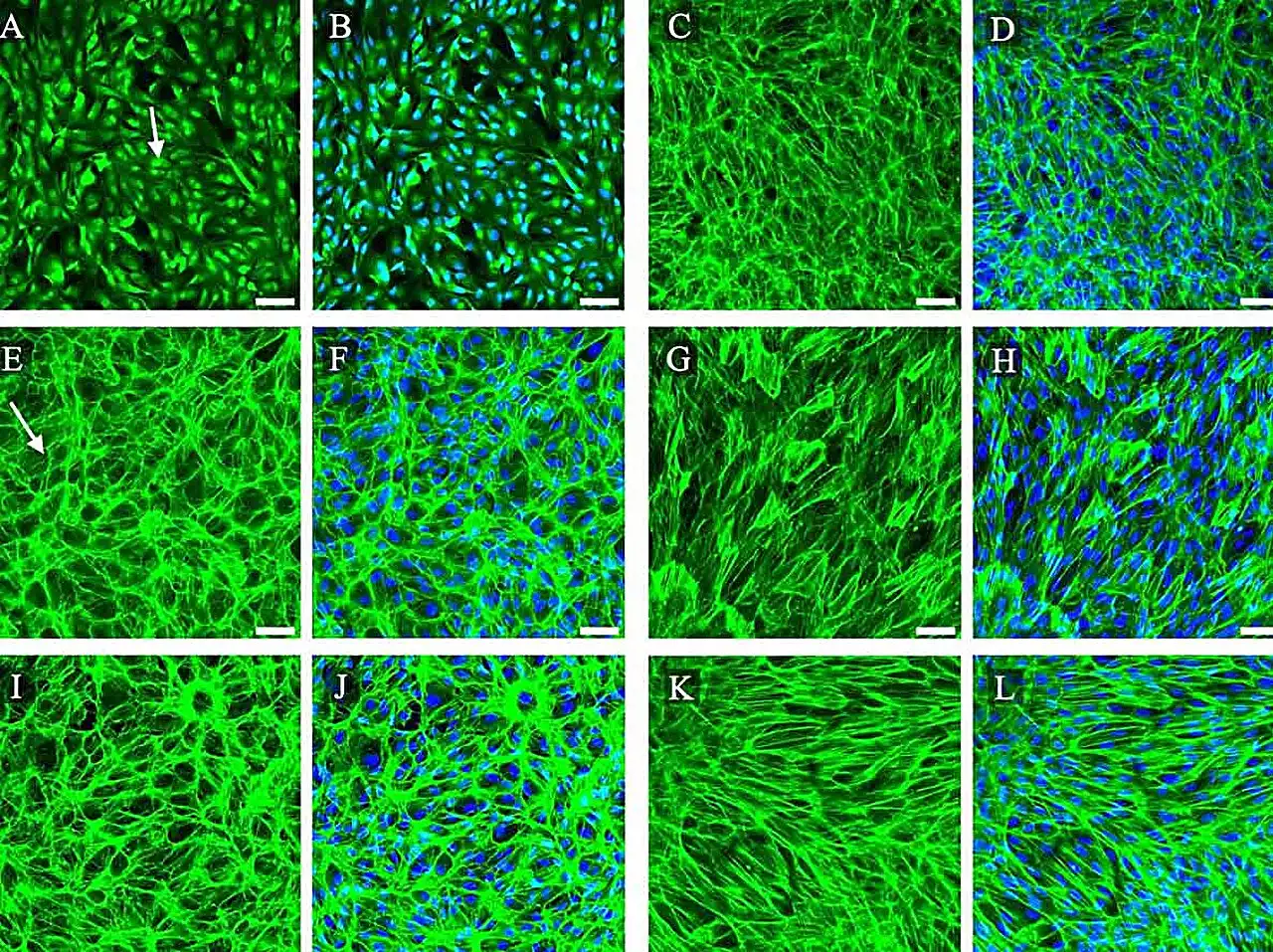 From hagfish to membrane: Modeling age-related macular degeneration