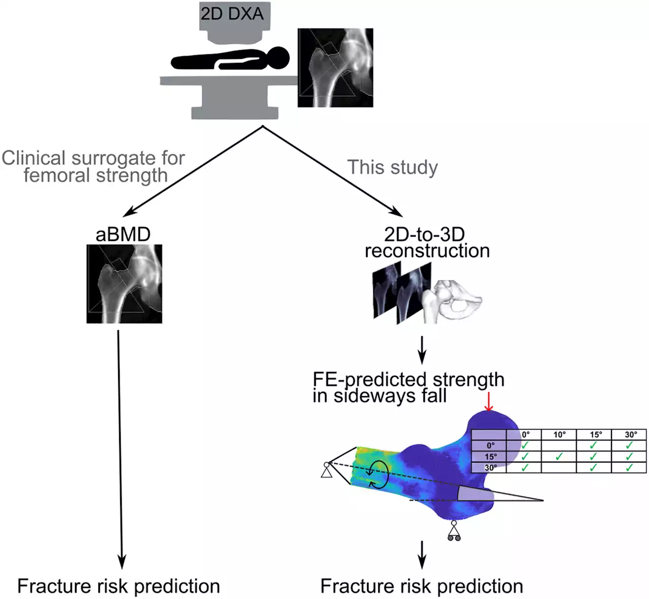 New method offers hope of fewer fractures