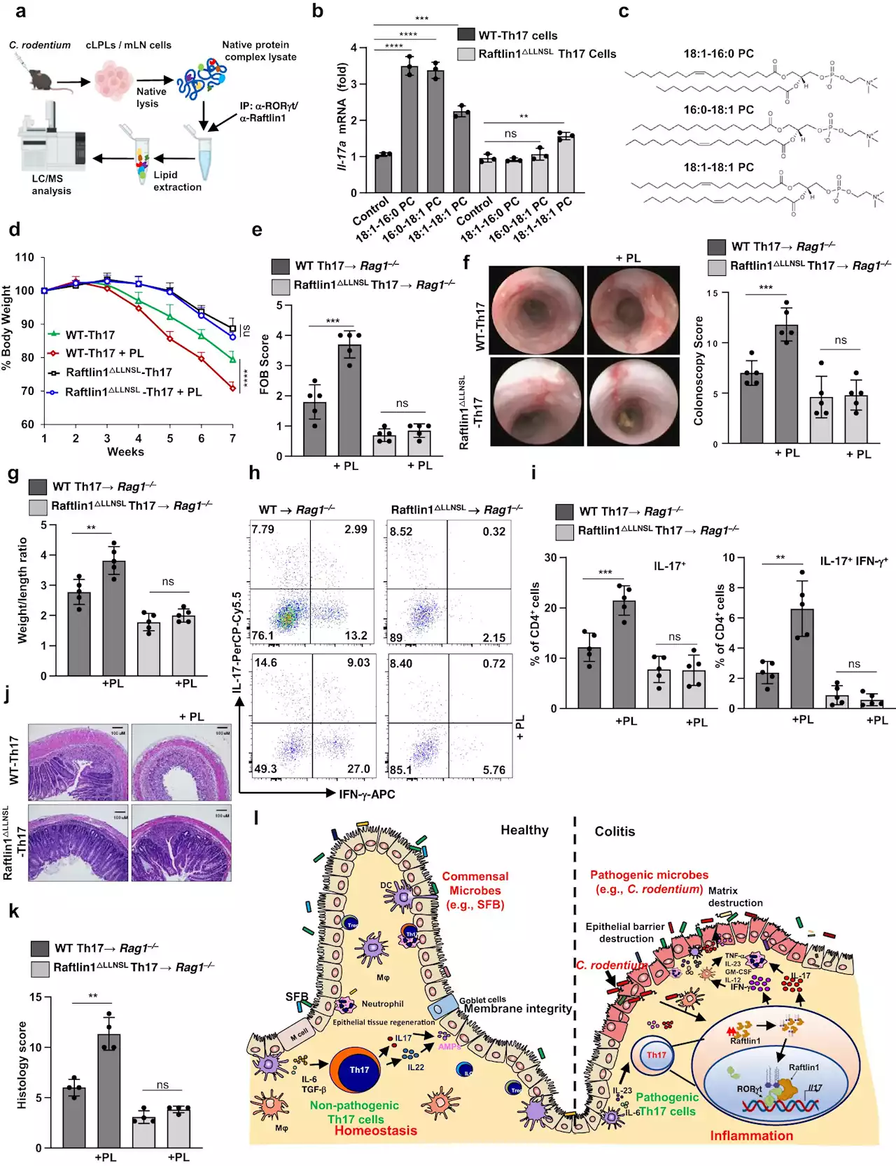 Researchers identify driver of inflammatory bowel disease