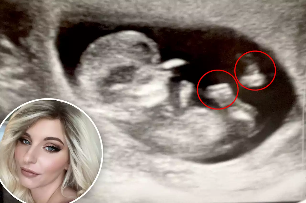 I see ‘American Idol’ judges in my ultrasound: pregnant woman