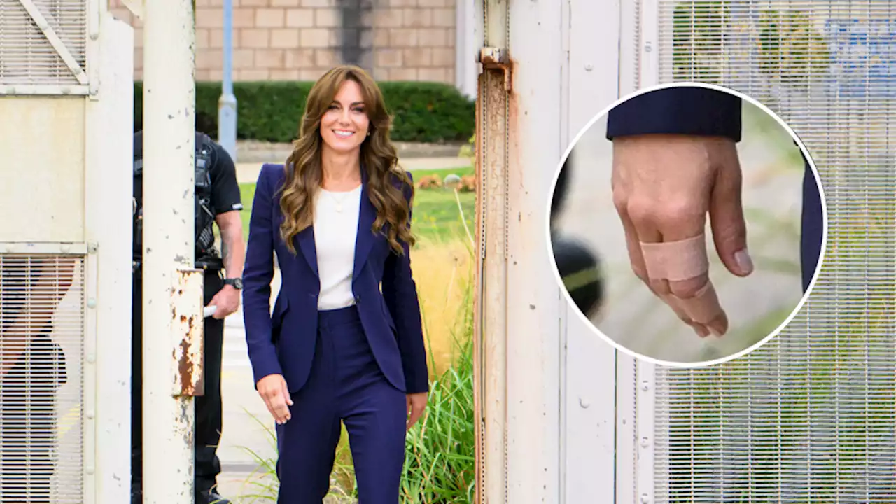 Kate Middleton: l’incidente domestico, la fasciatura e la visita al carcere