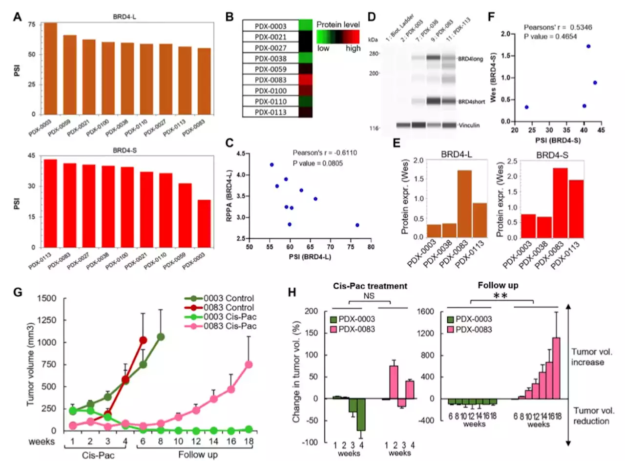 Increased BRD4-L and BRD4-S promotes chemotherapy resistance in ovarian carcinoma: Study