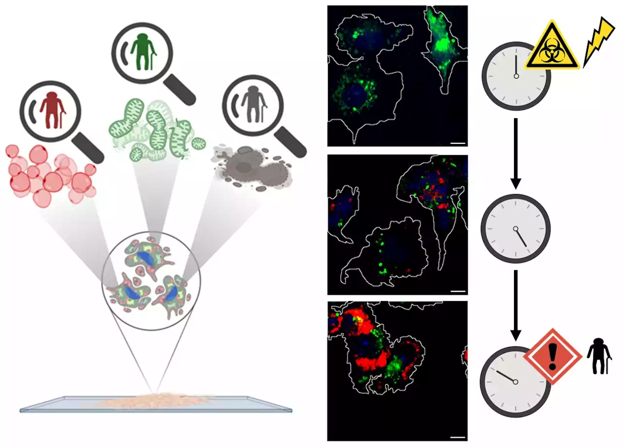 Study sheds light on one of the still poorly understood aspects of cancer