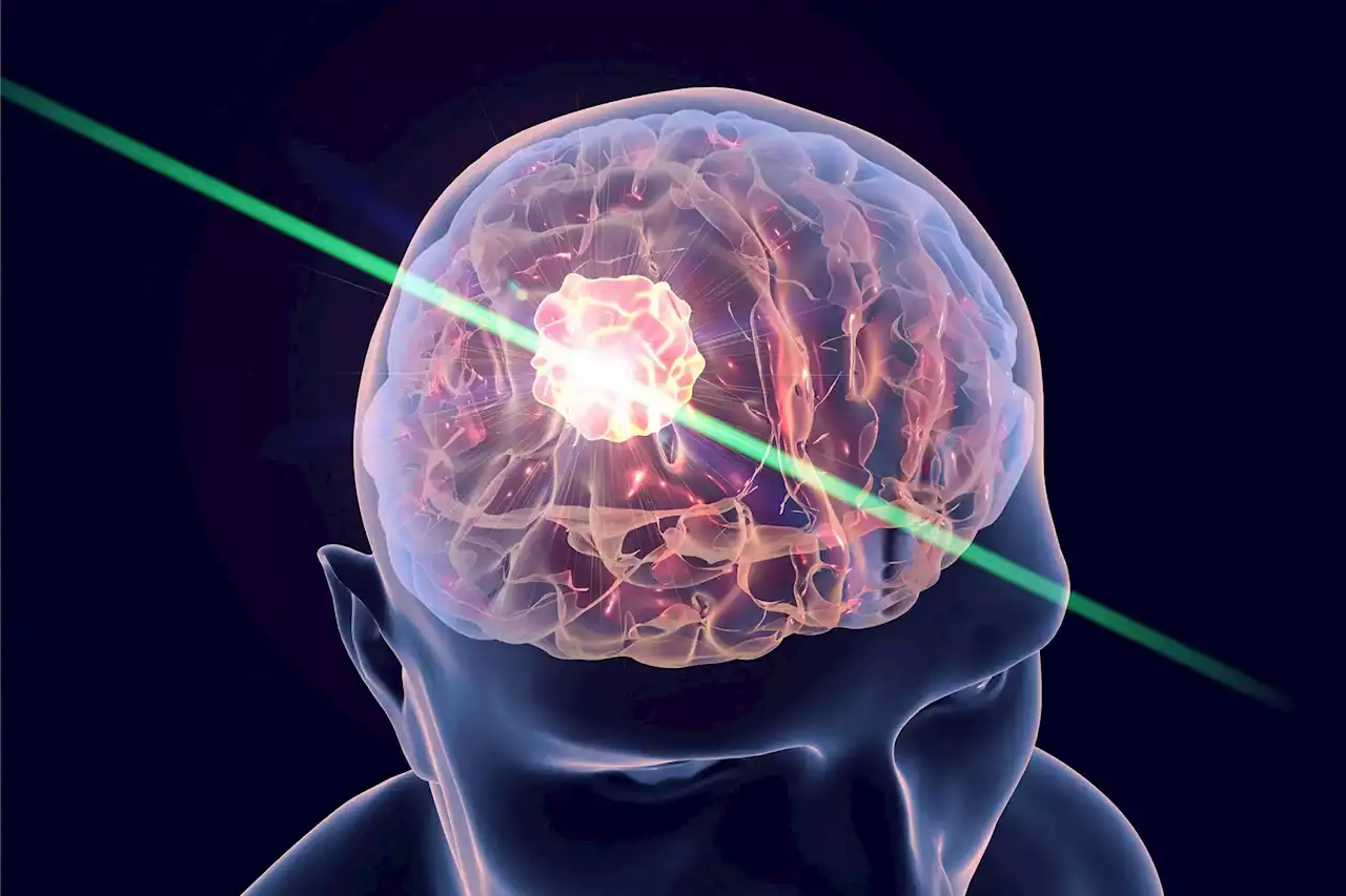 Quantum Signaling: A Revolutionary New Treatment for Brain Tumors