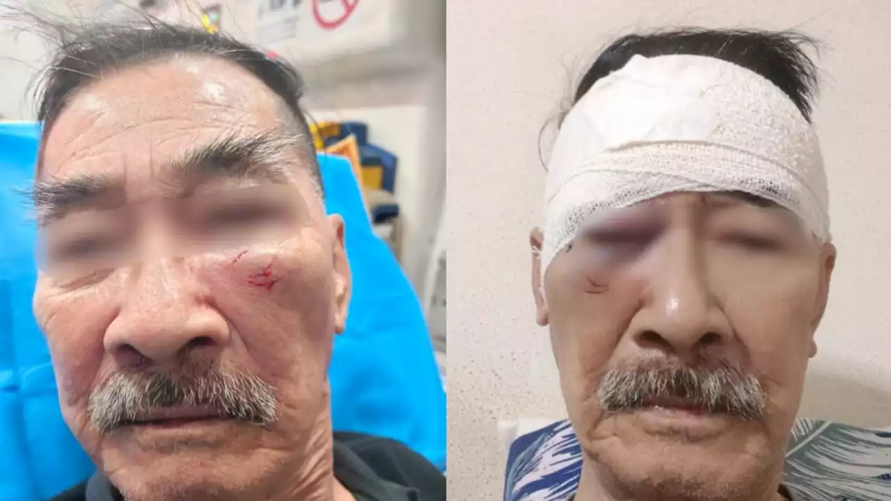 80-year-old security officer allegedly punched in the face while on duty at Bedok Central